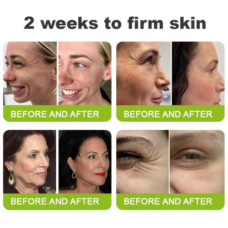Luxlne® Skin Tightening & Vita-A Retinol Retinol shot Anti-Wrinkle Firming Tightening cream