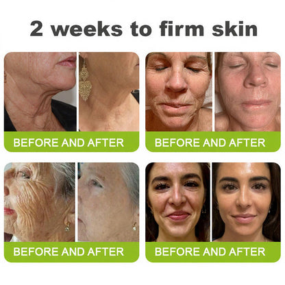 Luxlne® Skin Tightening & Vita-A Retinol Retinol shot Anti-Wrinkle Firming Tightening cream