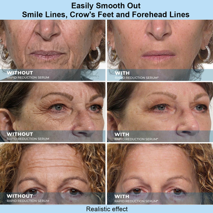 Luxlne Instant Face Temporary Tightener – Instant visible results in 60 seconds