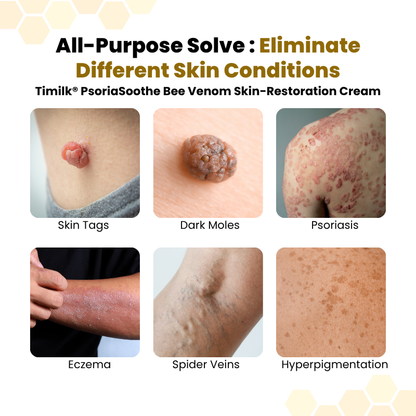 Luxlne® PsoriaSoothe Bee Venom Skin-Restoration Cream